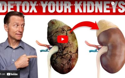 A Surprising Way to Cleanse Toxic Kidneys – Dr. Berg on Kidney Detoxification
