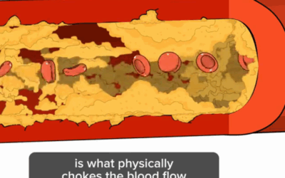 Keep you Blood Flowing Eliminate Plague Naturally – Statins Kill