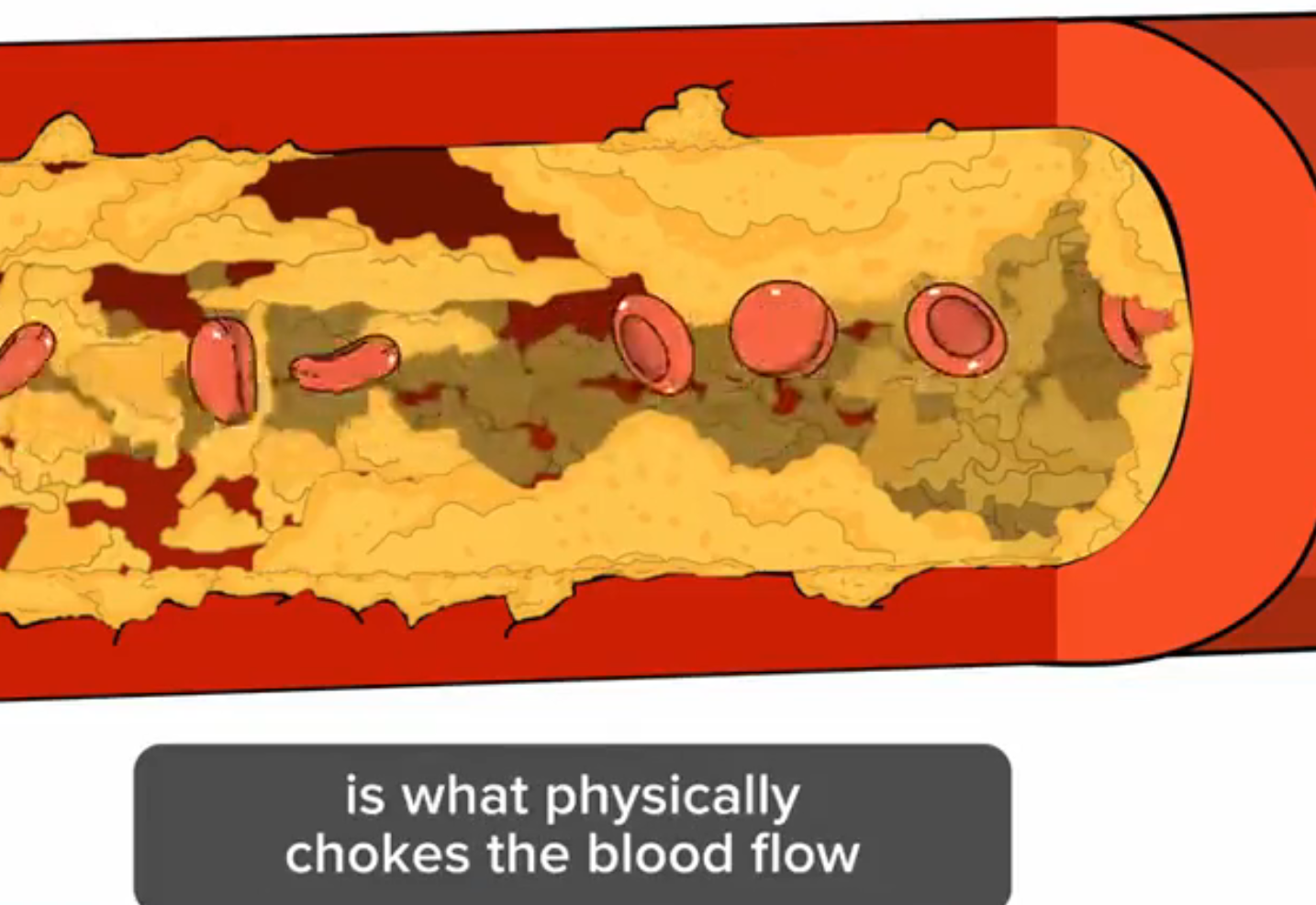hardest Prison in the mind