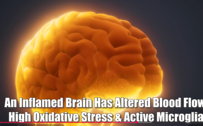 Breakthrough Research: This Is THE SECRET To Decalcify Your Pineal Gland